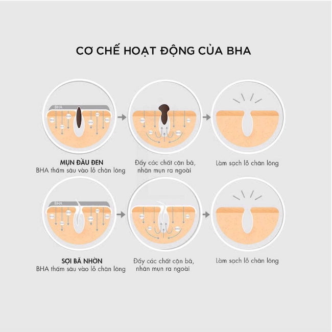 AHA/BHA Có Dùng Được Cho Da Mụn Không?