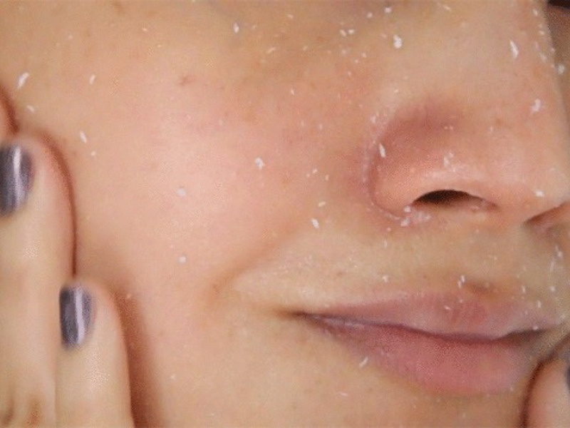 Phải Làm Thế Nào Khi Thoa Kem Chống Nắng Bị Vón Cục, Bí Bách?