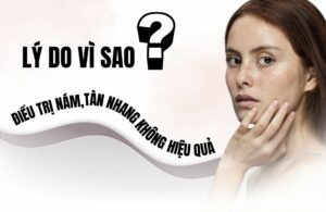 Điều trị nám tàn nhang không hiệu quả - Lý do vì sao? 2 Dieu tri nam tan nhang khong hieu qua Ly do vi sao