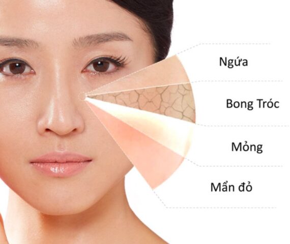 6 Dấu Hiệu Cho Thấy Da Bạn Là Da Nhạy Cảm