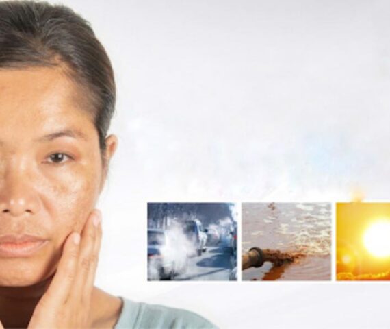 5 Dấu Hiệu Cho Thấy Làn Da Cần Được Thải Độc