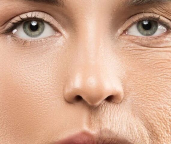 5 Thói Quen Làm Càng Sớm Da Càng Ít Nếp Nhăn Hơn