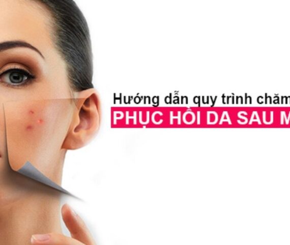 Phục Hồi Da Sau Nặn Mụn Tại Nhà Không Để Lại Thâm Nhanh Chóng