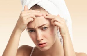 Phục Hồi Da Sau Nặn Mụn Tại Nhà Không Để Lại Thâm Nhanh Chóng