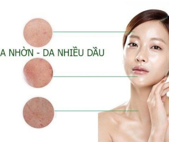 5 Cách Giảm Tiết Dầu Trên Da Mặt Hiệu Quả Tại Nhà