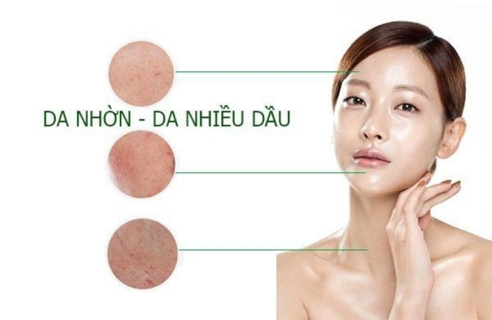 5 Cách Giảm Tiết Dầu Trên Da Mặt Hiệu Quả Tại Nhà