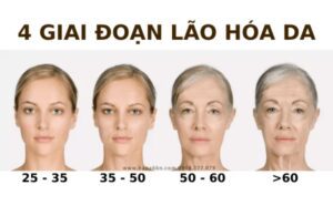 6 Bài Test Đơn Giản Tại Nhà Kiểm Tra Mức Độ Lão Hóa Da 3 Bài Test Đơn Giản Tại Nhà Kiểm Tra Mức Độ Lão Hóa Da