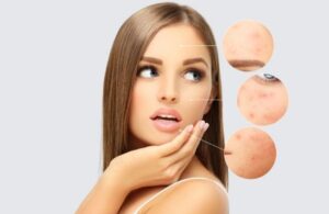 Những Loại Vitamin Cần Thiết Để Nuôi Dưỡng Làn Da Sáng Khỏe 4 Những Loại Vitamin Cần Thiết Để Nuôi Dưỡng Làn Da Sáng Khỏe