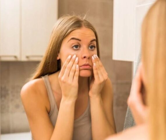 Nhưng Tín Hiệu Cho Thấy Làn Da Đang Kêu Cứu - Thải Độc Cho Làn Da