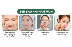 Phục Hồi Da Sau Nặn Mụn Tại Nhà Không Để Lại Thâm Nhanh Chóng