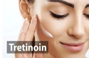 Có Nên Dùng Tretinoin Để Trị Mụn Không? Cách Dùng Đúng Chuẩn 2 Có Nên Dùng Tretinoin Để Trị Mụn Không? Cách Dùng Đúng Chuẩn