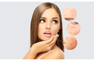 Vitamin Nào Cần Thiết Để Làn Da Luôn Sáng Khỏe?