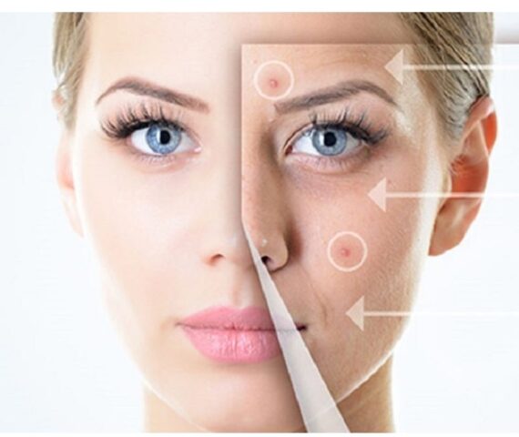 Retinol Có Trị Thâm Được Không? Giải Mã Cơ Chế Hoạt Động