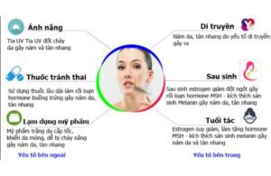 Nám Da Từ Đâu Mà Có? Cách Tránh Các Tác Nhân Hình Thành Nám