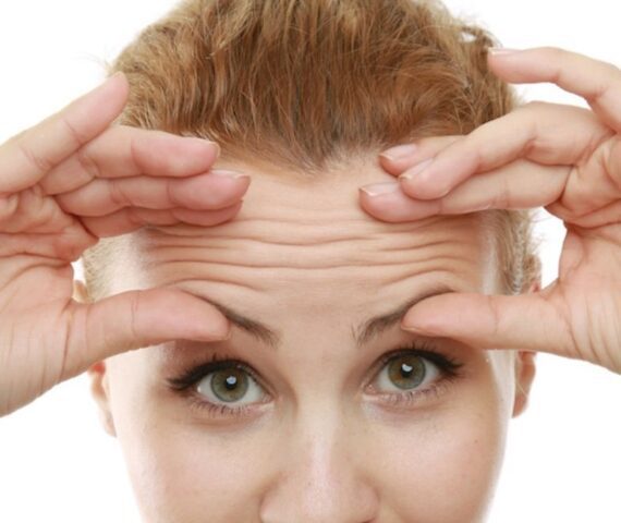 Các Nếp Nhăn Sẽ Xuất Hiện Vào Thời Điểm Nào? Có Cách Nào Để Phòng Tránh?