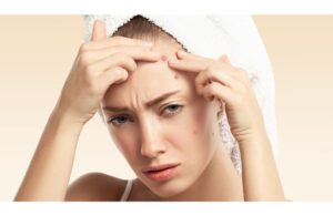 Da Dễ Nổi Mụn Khi Thay Đổi Thời Tiết Xấu Đi? Lý Do Tại Sao? 2 Da Dễ Nổi Mụn Khi Thay Đổi Thời Tiết Xấu Đi? Lý Do Tại Sao?