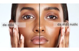 Da Dầu Cần Gì Da Khô Đang Thiếu Gì? Liệu Bạn Đã Thực Sự Hiểu 4 Da Dầu Cần Gì Da Khô Đang Thiếu Gì? Liệu Bạn Đã Thực Sự Hiểu