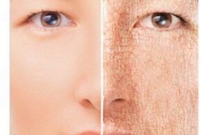 Da Dầu Cần Gì Da Khô Đang Thiếu Gì? Liệu Bạn Đã Thực Sự Hiểu 3 Da Dầu Cần Gì Da Khô Đang Thiếu Gì? Liệu Bạn Đã Thực Sự Hiểu