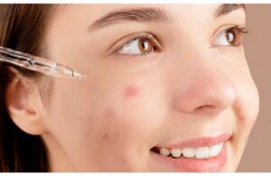 Các Tiêu Chí Chọn Serum Cho Da Mụn Bạn Đã Biết? 2 Các Tiêu Chí Chọn Serum Cho Da Mụn Bạn Đã Biết?