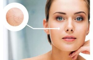 Da Mặt Ngứa Ráp Mỗi Khi Ở Trong Điều Hòa? Cách Khắc Phục 4 Da Mặt Ngứa Ráp Mỗi Khi Ở Trong Điều Hòa? Cách Khắc Phục