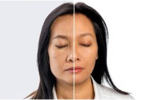 Dùng Retinol Để Trẻ Hóa Nhưng Cũng Dễ Lão Hóa Nếu Như Bạn Không Biết Những Điều Sau