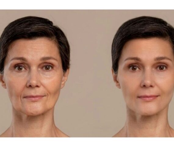 Dùng Retinol Để Trẻ Hóa Nhưng Cũng Dễ Lão Hóa Nếu Như Bạn Không Biết Những Điều Sau