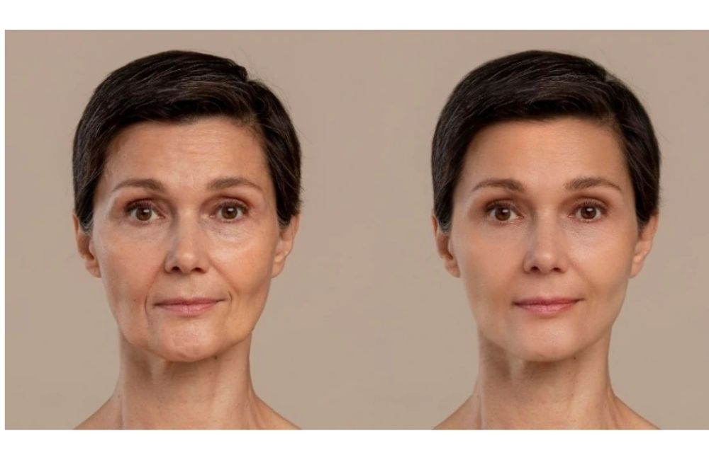 Dùng Retinol Để Trẻ Hóa Nhưng Cũng Dễ Lão Hóa Nếu Như Bạn Không Biết Những Điều Sau