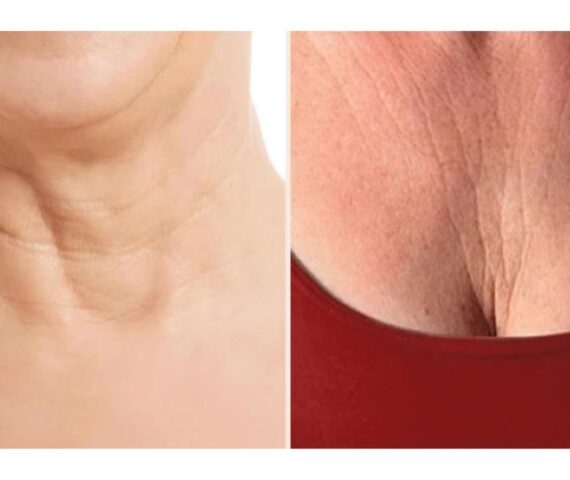 Không Thoa Kem Chống Nắng Vùng Cổ Sẽ Làm Vùng Da Cổ Lão Hóa