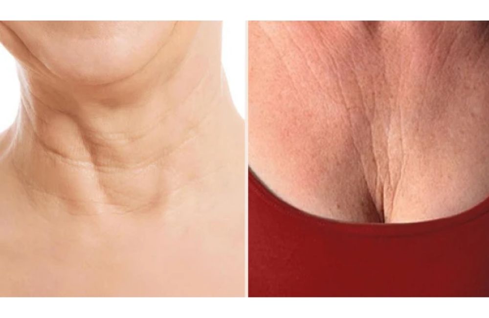 Không Thoa Kem Chống Nắng Vùng Cổ Sẽ Làm Vùng Da Cổ Lão Hóa 1 Không Thoa Kem Chống Nắng Vùng Cổ Sẽ Làm Vùng Da Cổ Lão Hóa