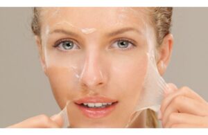 Peel Da Và Treatment Khác Nhau Ở Điểm Nào? Nên Chọn Phương Pháp Làm Đẹp Nào