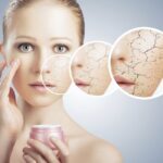 Những Hoạt Chất Tuyệt Đối Không Được Bôi Lên Da, Dừng Ngay Nếu Bạn Đang Dùng