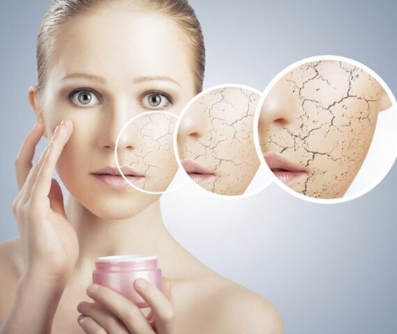 Những Hoạt Chất Tuyệt Đối Không Được Bôi Lên Da, Dừng Ngay Nếu Bạn Đang Dùng