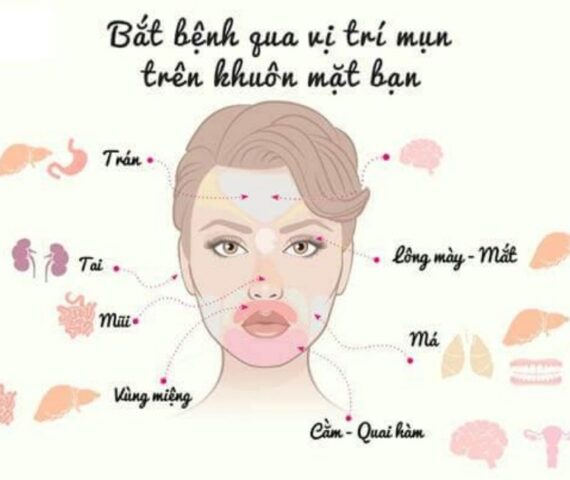 Vị Trí Mụn Mọc Trên Mặt Đang Cảnh Báo Điều Gì Về Sức Khỏe