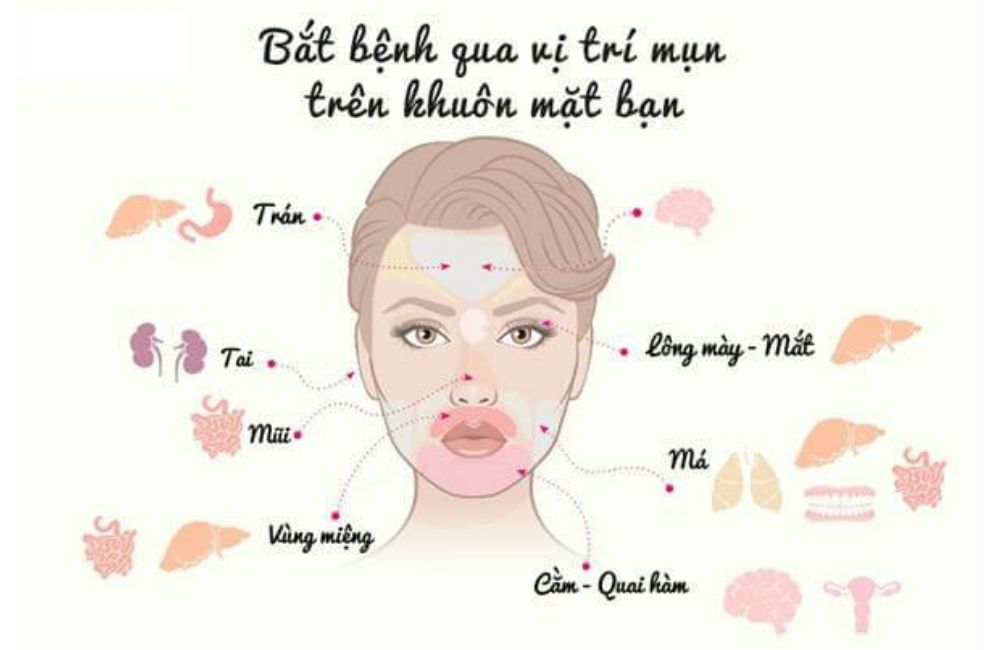 Vị Trí Mụn Mọc Trên Mặt Đang Cảnh Báo Điều Gì Về Sức Khỏe