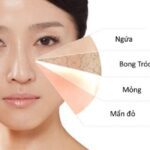 7 Lý Do Khiến Da Khô Sạm Hơn Khi Thời Tiết Hanh Khô Đổ Bộ