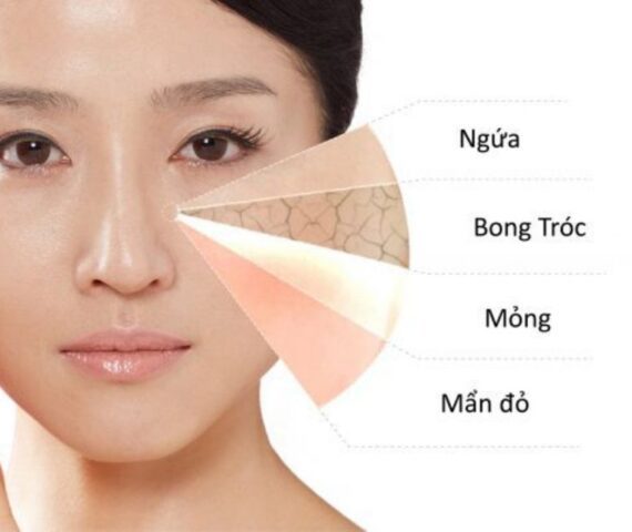 7 Lý Do Khiến Da Khô Sạm Hơn Khi Thời Tiết Hanh Khô Đổ Bộ