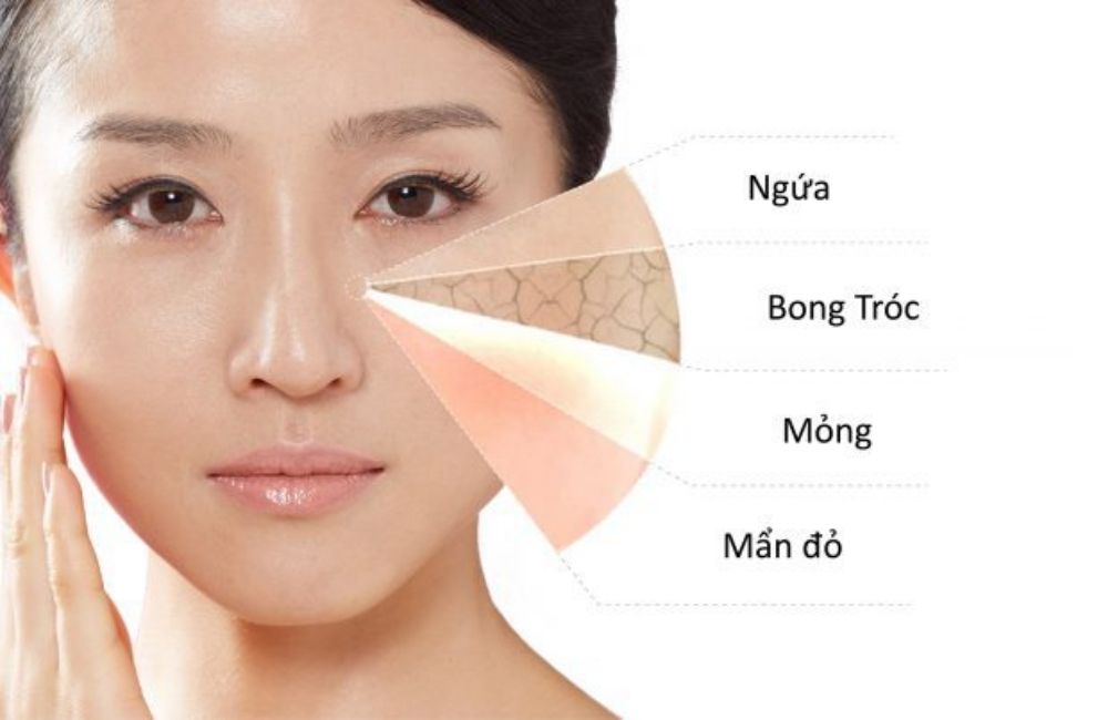 7 Lý Do Khiến Da Khô Sạm Hơn Khi Thời Tiết Hanh Khô Đổ Bộ