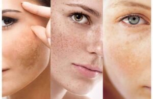 Thoa Vitamin C Sao Cho Nhanh Trắng Và Bảo Quản Đúng Cách 2 Thoa Vitamin C Sao Cho Nhanh Trắng Và Bảo Quản Đúng Cách