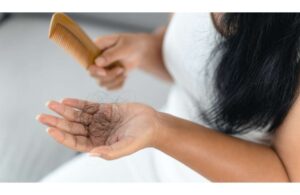 Cách Khắc Phục Bệnh Rụng Tóc Ở Nữ Giới: Nguyên Nhân Và Giải Pháp Hiệu Quả