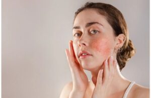 Hướng Dẫn Bạn Chi Tiết Chăm Sóc Da Theo Chu Kỳ Của Nội Tiết Tố 2 Hướng Dẫn Bạn Chi Tiết Chăm Sóc Da Theo Chu Kỳ Của Nội Tiết Tố
