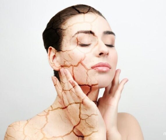 Da Nhanh Lão Hóa Hơn Trong Thời Tiết Hanh Khô Liệu Bạn Đã Biết?