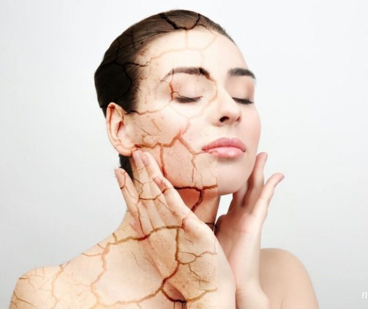 Da Nhanh Lão Hóa Hơn Trong Thời Tiết Hanh Khô Liệu Bạn Đã Biết?