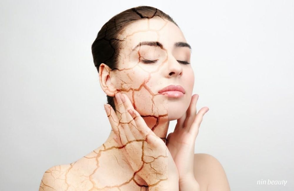 Da Nhanh Lão Hóa Hơn Trong Thời Tiết Hanh Khô Liệu Bạn Đã Biết?