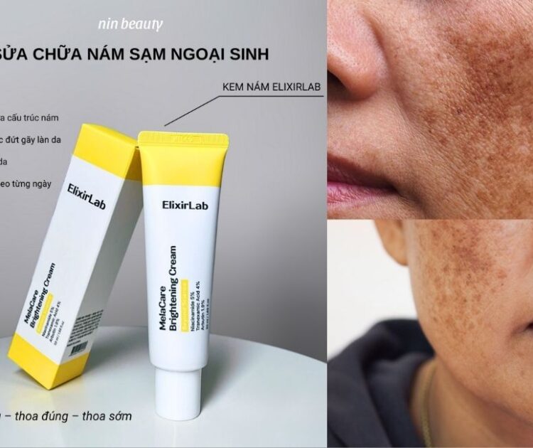Cách Sử Dụng Kem Nám ElixirLab Để Phục Hồi Làn Da Nám Lâu Năm
