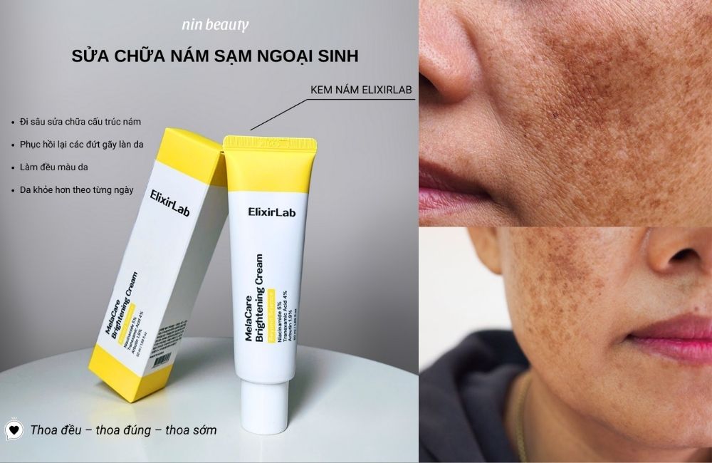 Cách Sử Dụng Kem Nám ElixirLab Để Phục Hồi Làn Da Nám Lâu Năm