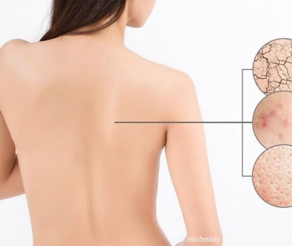 Làn Da Body Bị Quá Tải Bụi Bẩn Thì Điều Gì Sẽ Xảy Ra? Phương Pháp Dọn Bụi Bẩn Da Body