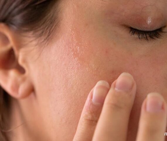 Tips Chăm Sóc Da Nhạy Cảm Trong Thời Tiết Hanh Khô Tháng 11