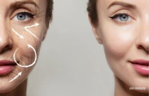 Da Nhanh Lão Hóa Hơn Trong Thời Tiết Hanh Khô Liệu Bạn Đã Biết?