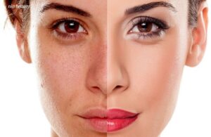 Tại Sao Da Càng Khô Lại Dễ Nám Và Lão Hóa Và Đây Là Cách Chăm Sóc Hiệu Quả 4 Tại Sao Da Càng Khô Lại Dễ Nám Và Lão Hóa Và Đây Là Cách Chăm Sóc Hiệu Quả