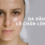 Bóc Trần Sự Thật Về Làn Da Đổ Dầu Và Có Nên Cải Thiện Da Dầu?